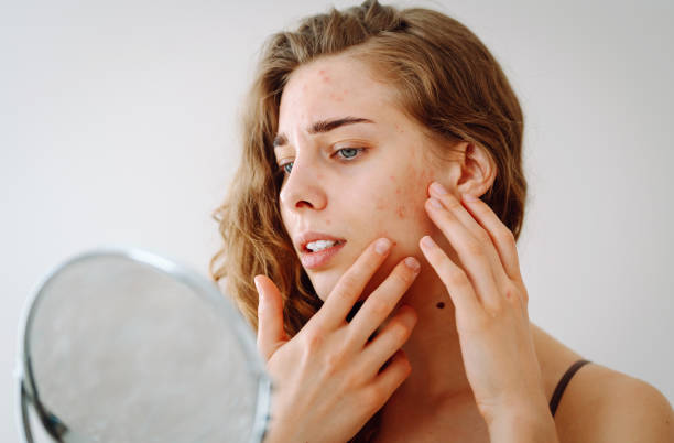Skin Concerns